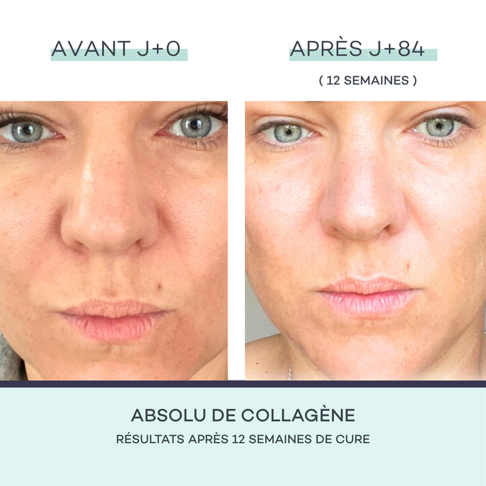 Absolu de Collagène