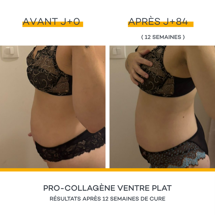 Coffret Minceur - Mangue