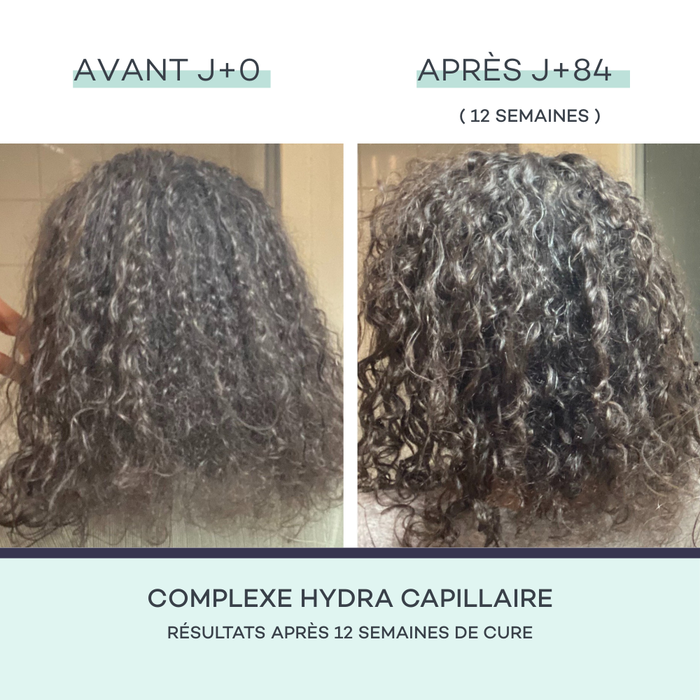 Complexe Hydra-Capillaire