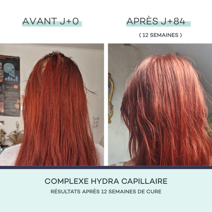 Complexe Hydra-Capillaire