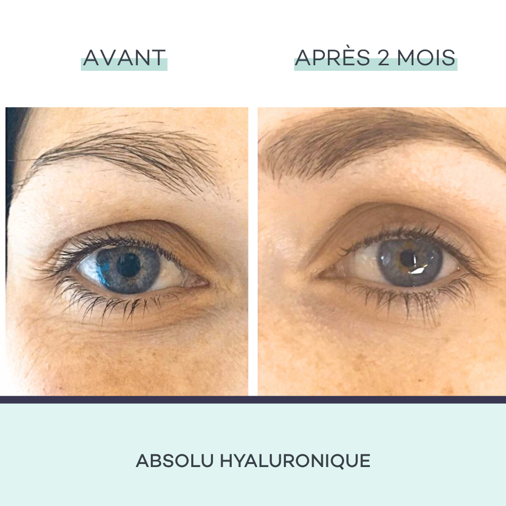 Absolu Hyaluronique