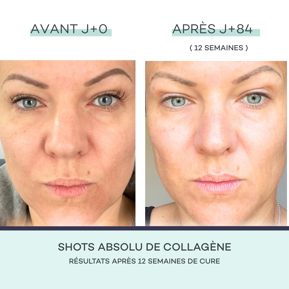 Shots de Collagène