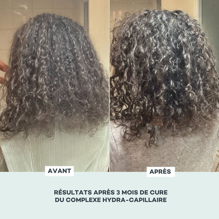 Complexe Hydra-Capillaire