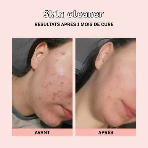 Skin Cleaner - Déstockage Arrêt Ref