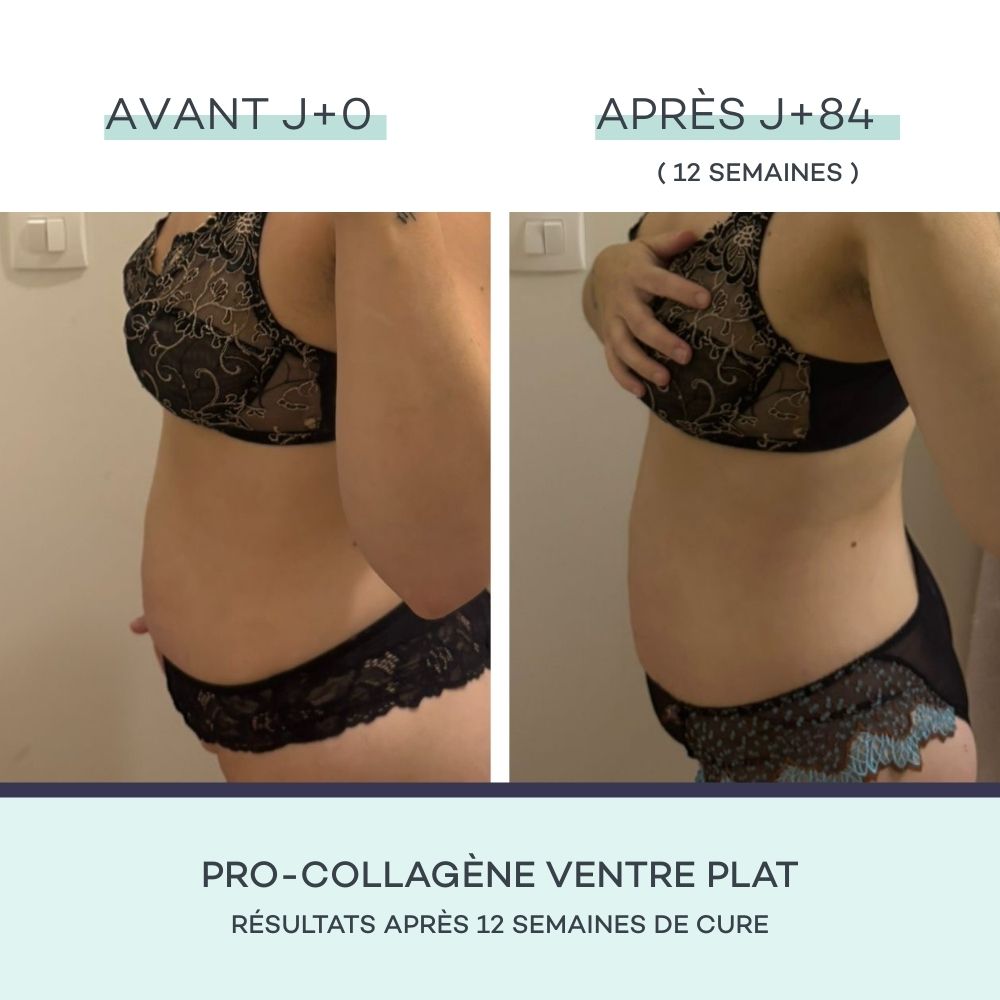 Coffret Minceur - Mangue