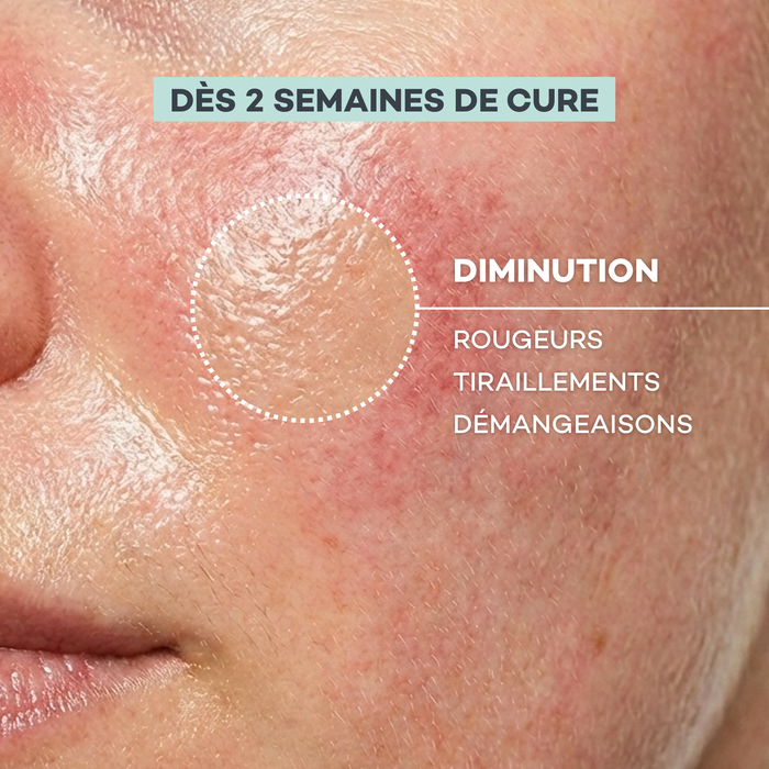 Routine Peau Sensible