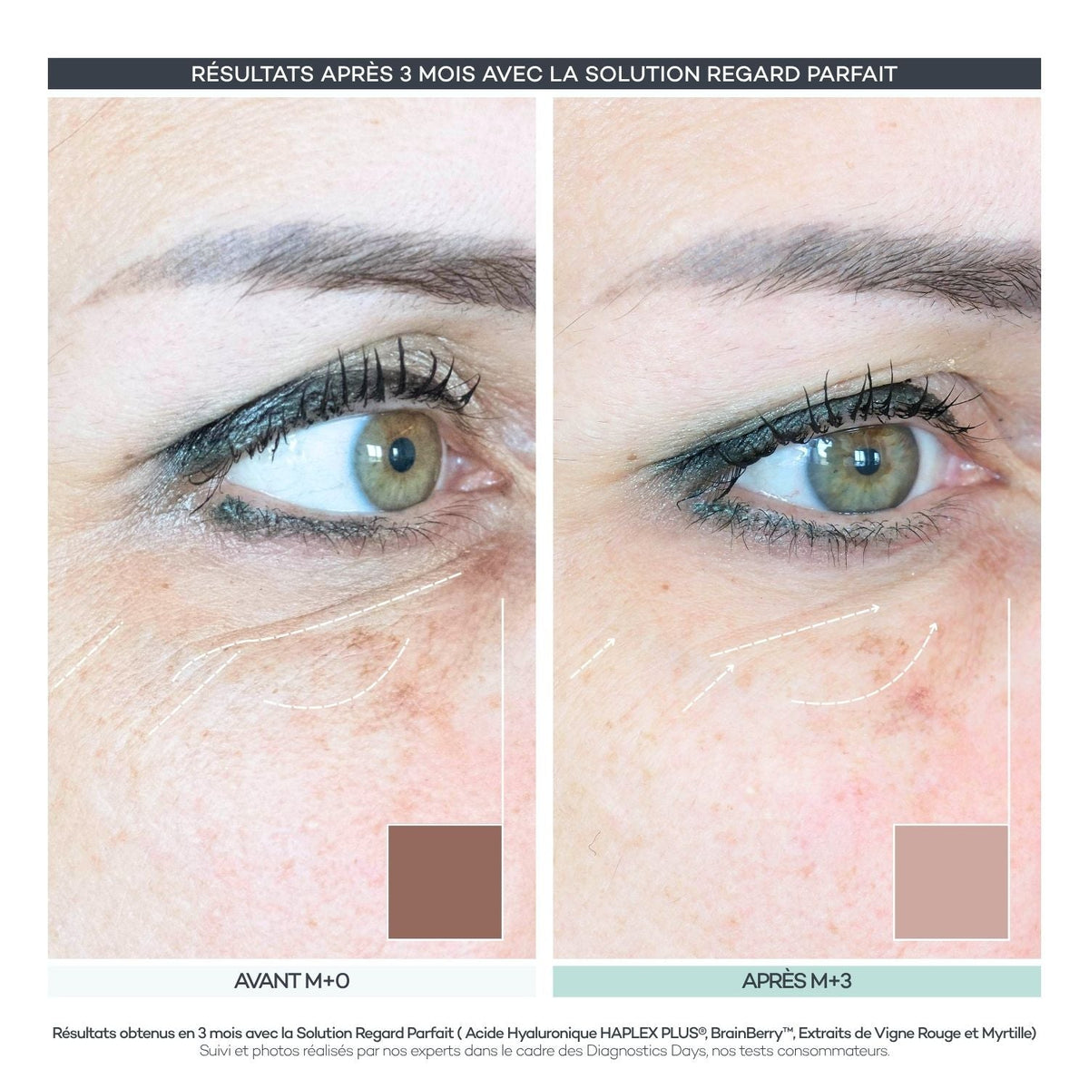 Avant après 3 mois du Shot Regard Parfait de la Routine Découverte Peau D-LAB : contour des yeux lissé et cerne éclairci à M+3