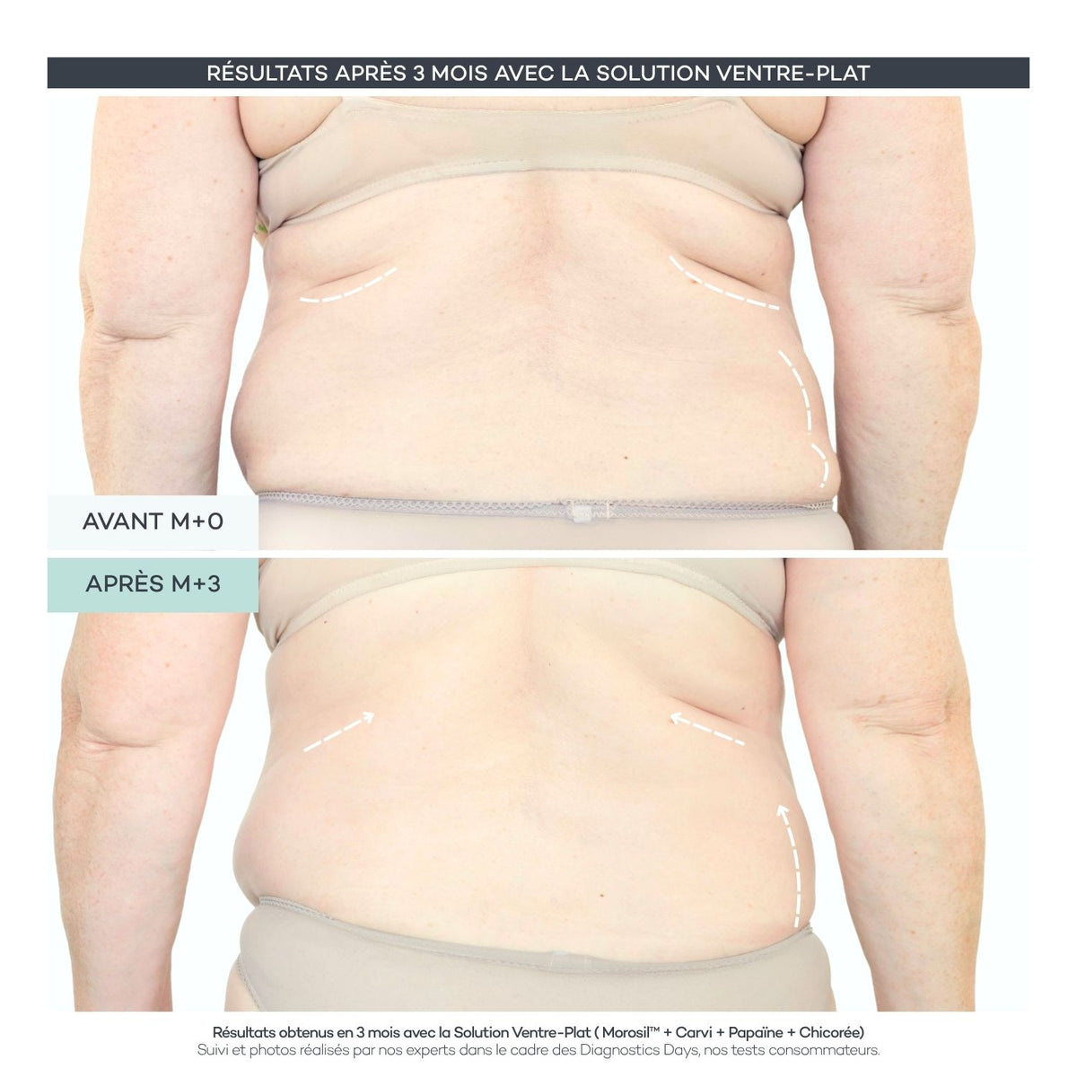 Solution Ventre-Plat - Body-Reset