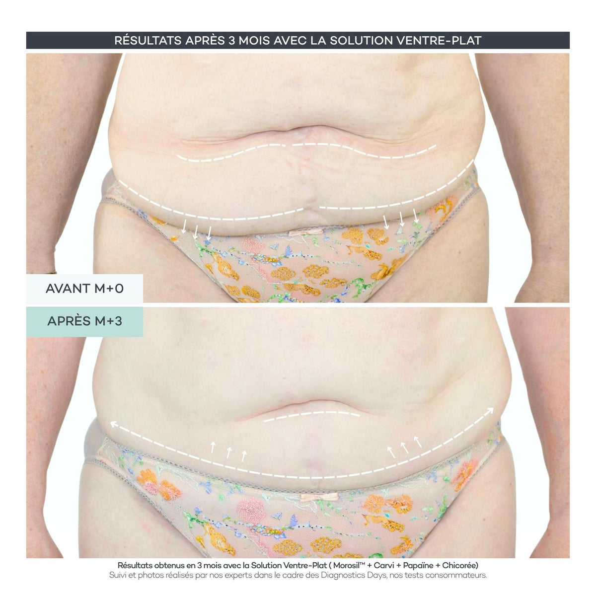 Solution Ventre-Plat - Body-Reset