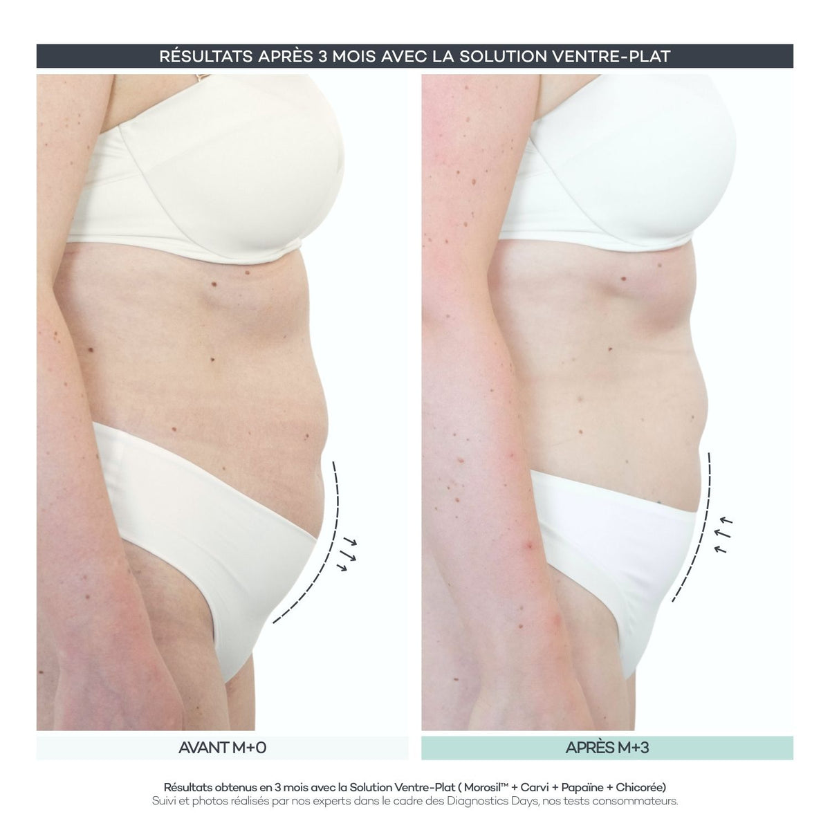 Solution Ventre-Plat - Body-Reset