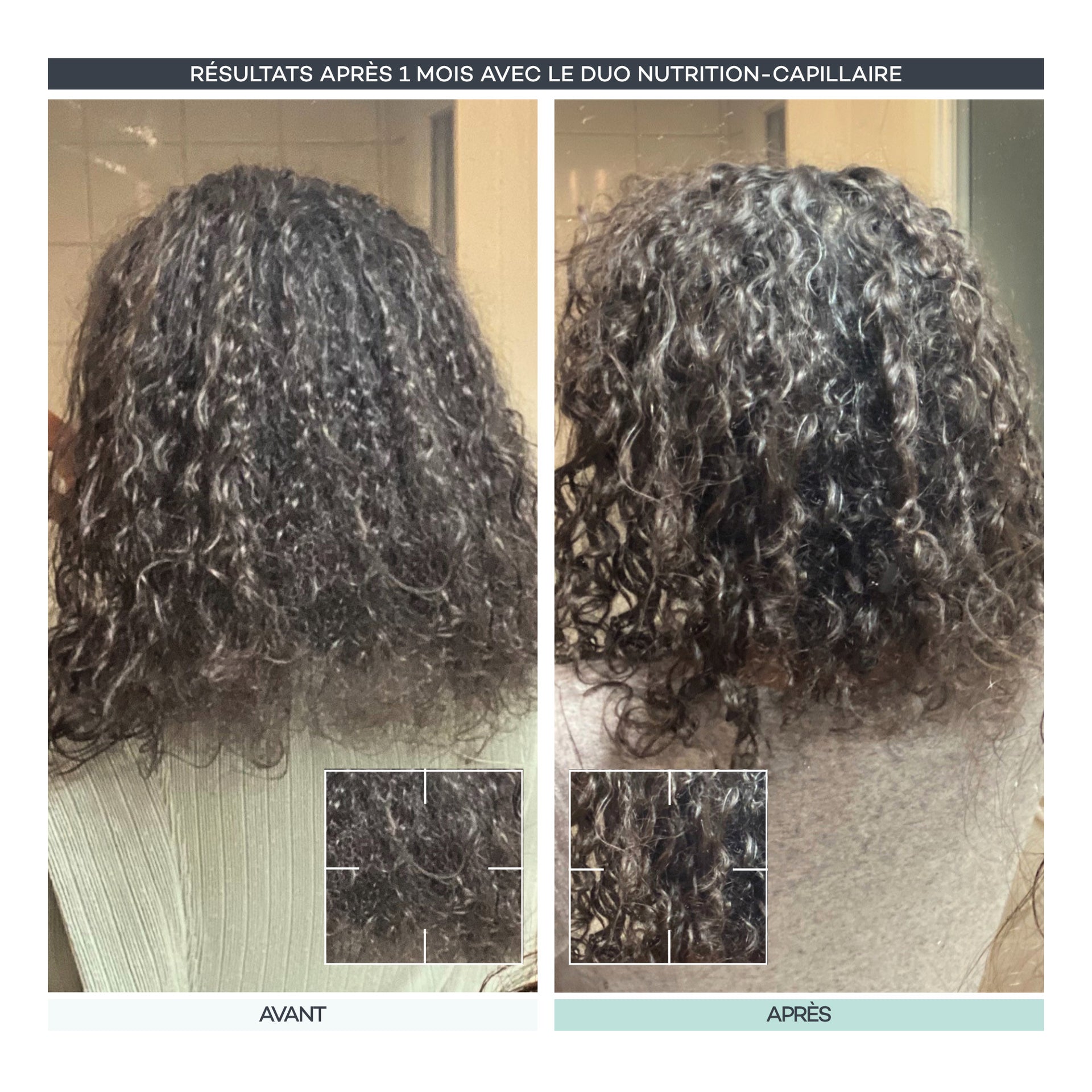 Routine Nutrition-Capillaire
