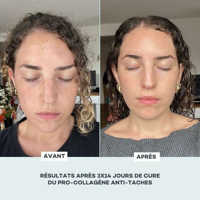 Pro-Collagène Anti-Taches - Date courte