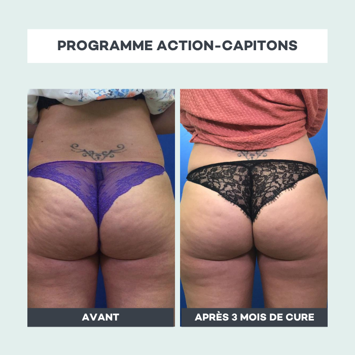 Routine Action-Capitons