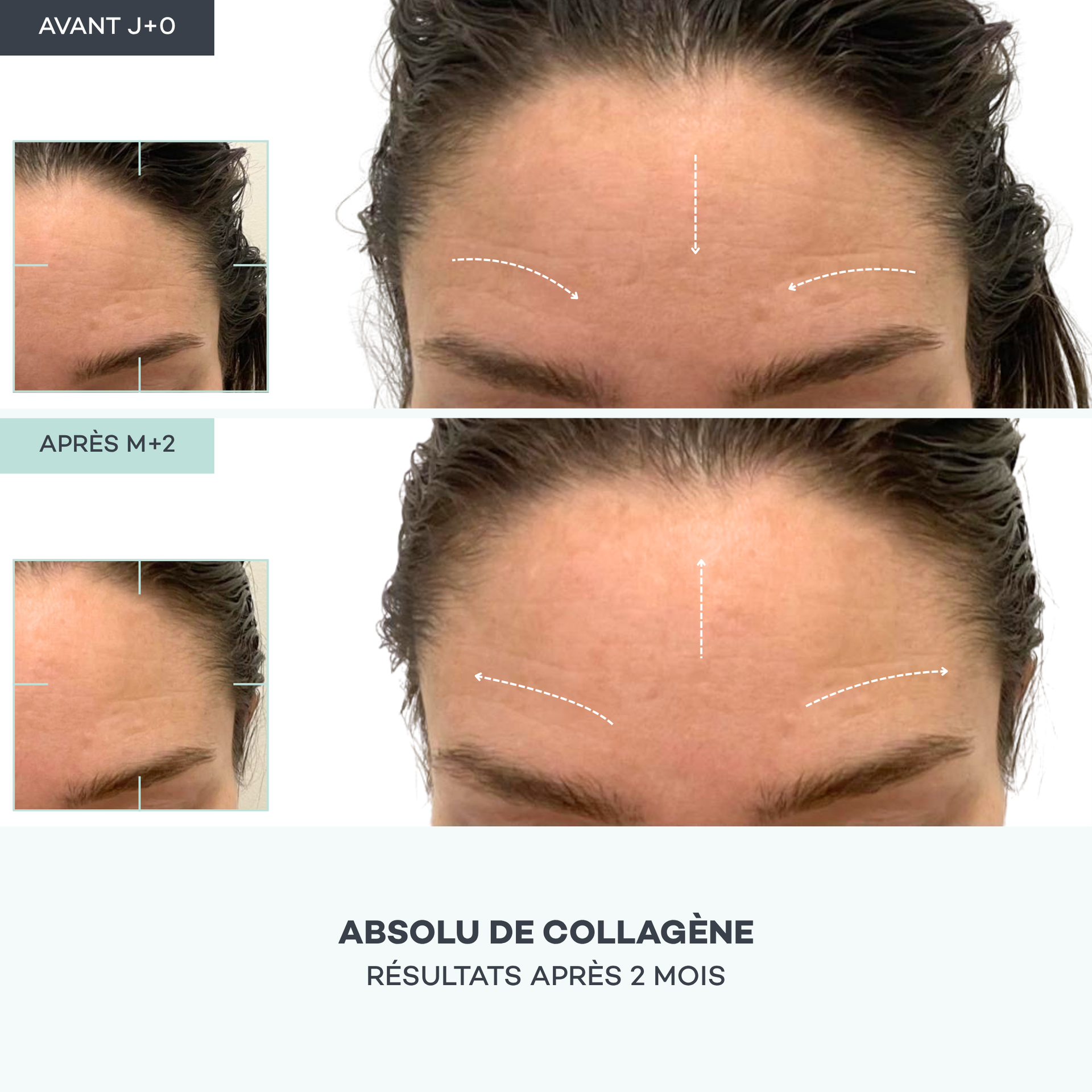 Absolu de Collagène