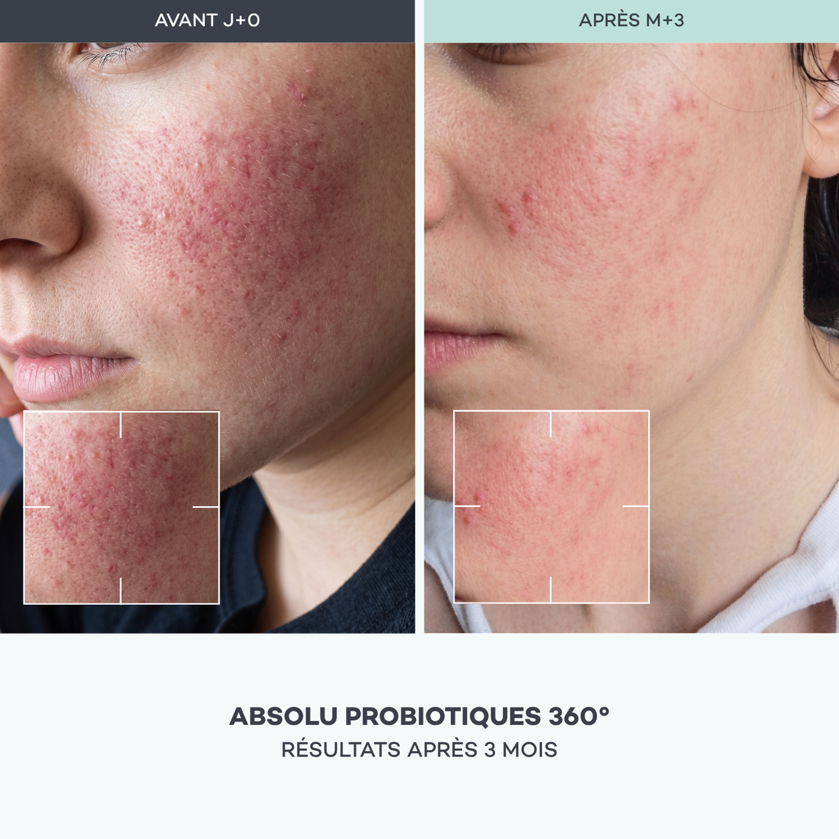 Absolu Probiotiques 360°