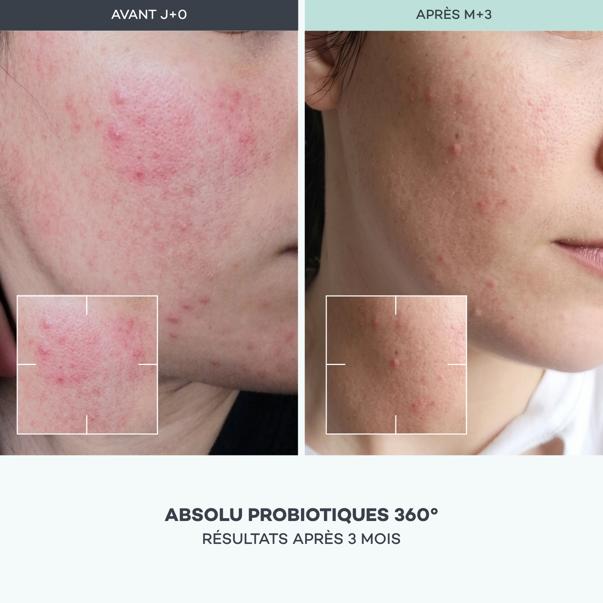 Absolu Probiotiques 360°