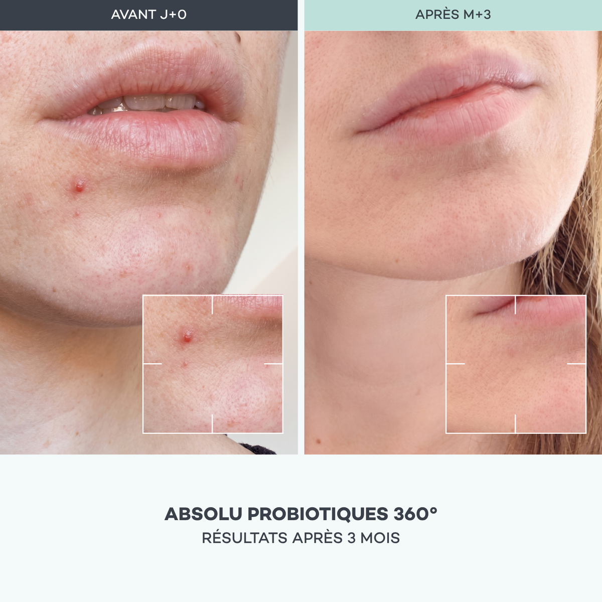Absolu Probiotiques 360°
