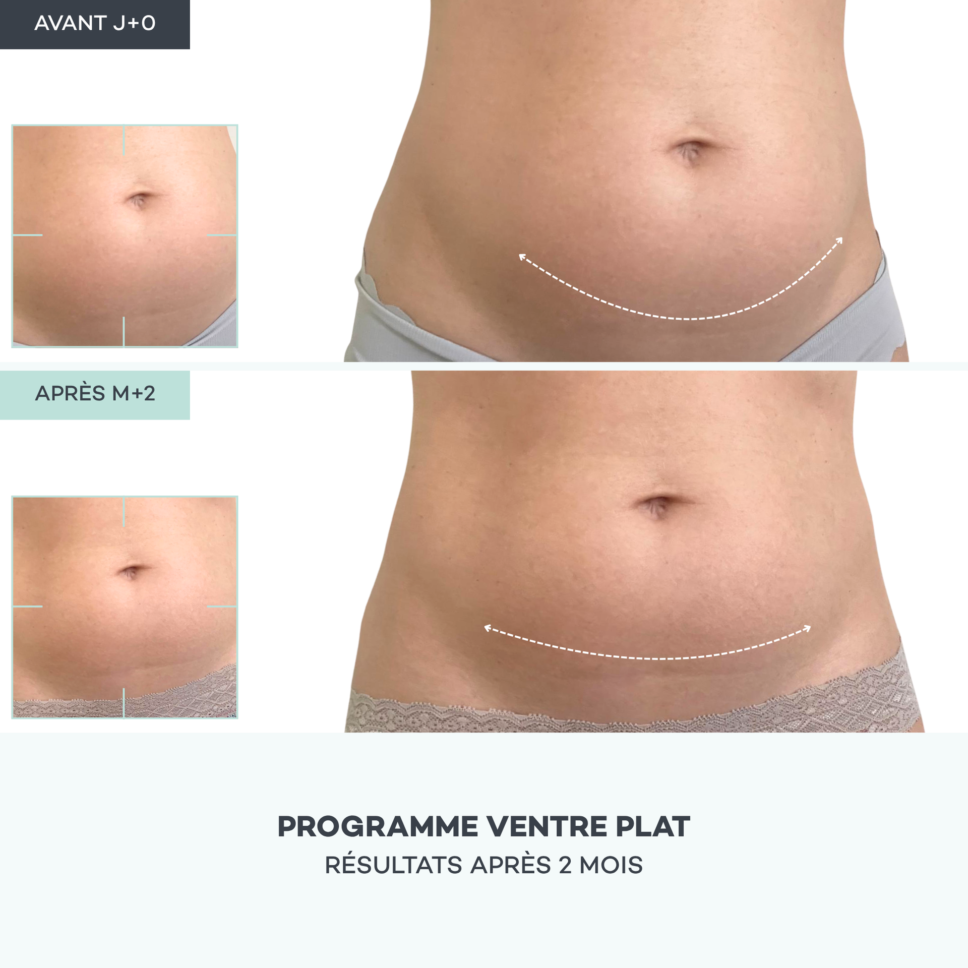 Routine Ventre Plat