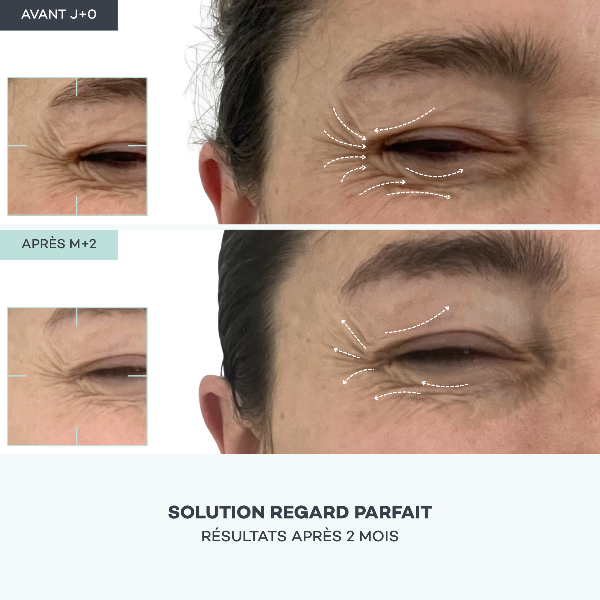 Shots Regard Parfait - Contour des Yeux