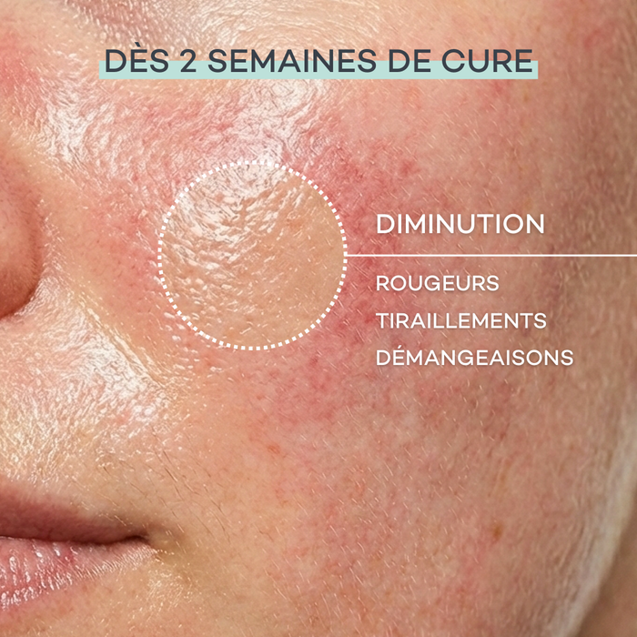 Routine Peau Sensible