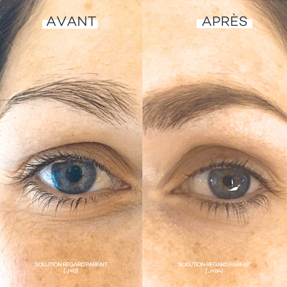 Perfect Eye Contour Solution