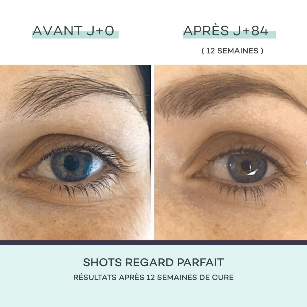 Shots Contour des Yeux