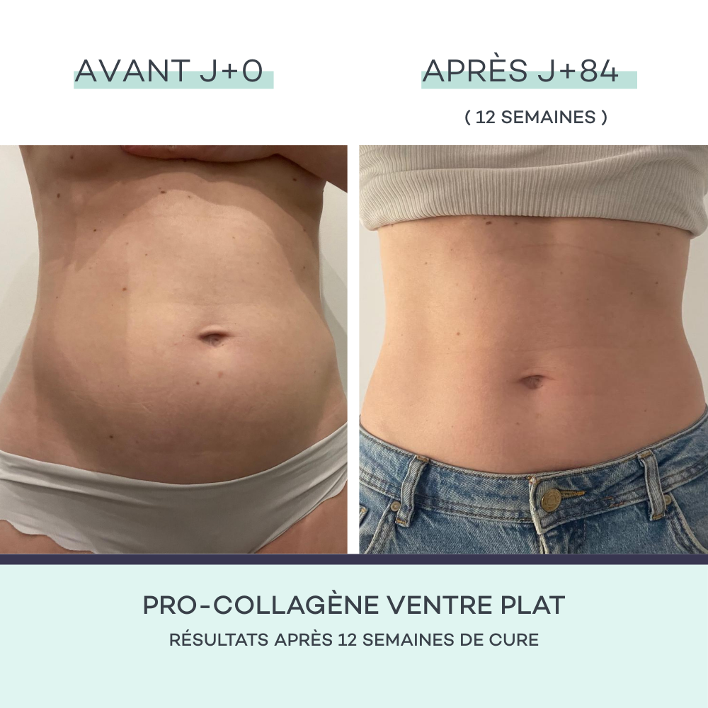 Sticks Ventre Plat - Mangue